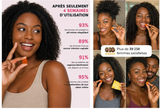 Gummies Bien-Être Féminin – Probiotique & Ananas